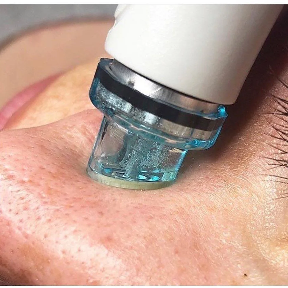 Hydrafacial