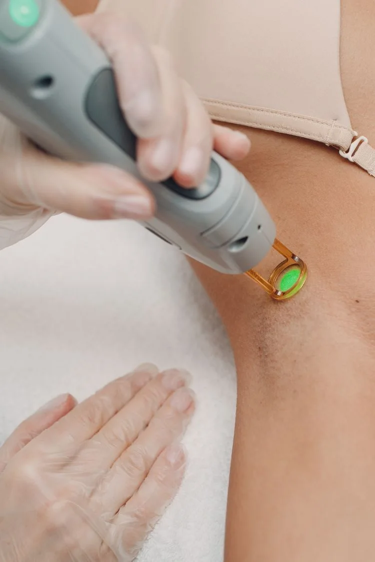 Épilation laser Clarity II