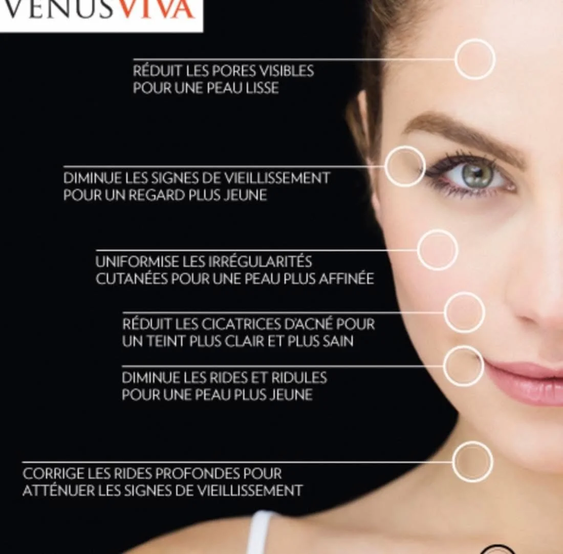 Visuel Venus Viva présentant les zones traitées